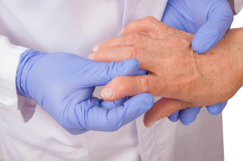 L’arthrose : un problème de santé publique